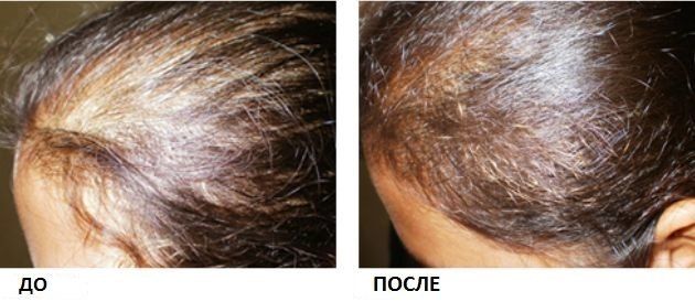 Как лечить кожу головы и волосы после окрашивания